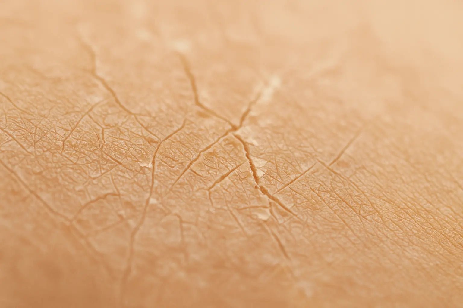 Vlaženje suhe kože: ali so olja in masla dovolj? - Skinfairytale